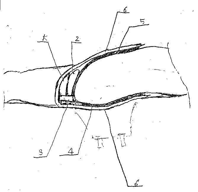 }P